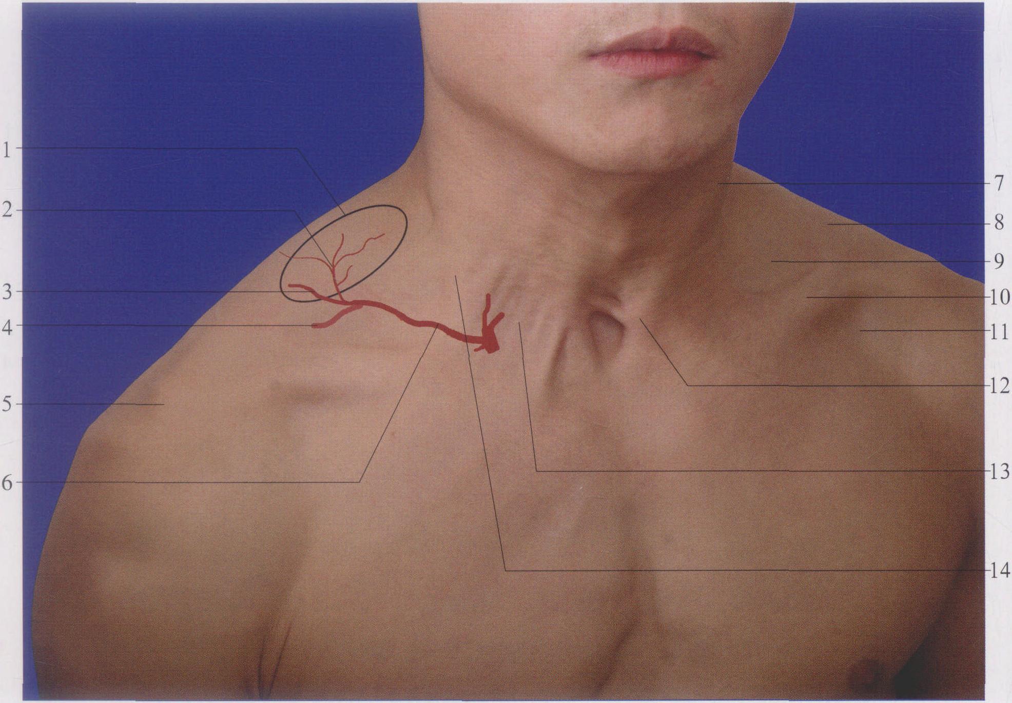 2.2.4 游离皮瓣(吻合血管的皮瓣)移植-骨科创面修复手术-医学